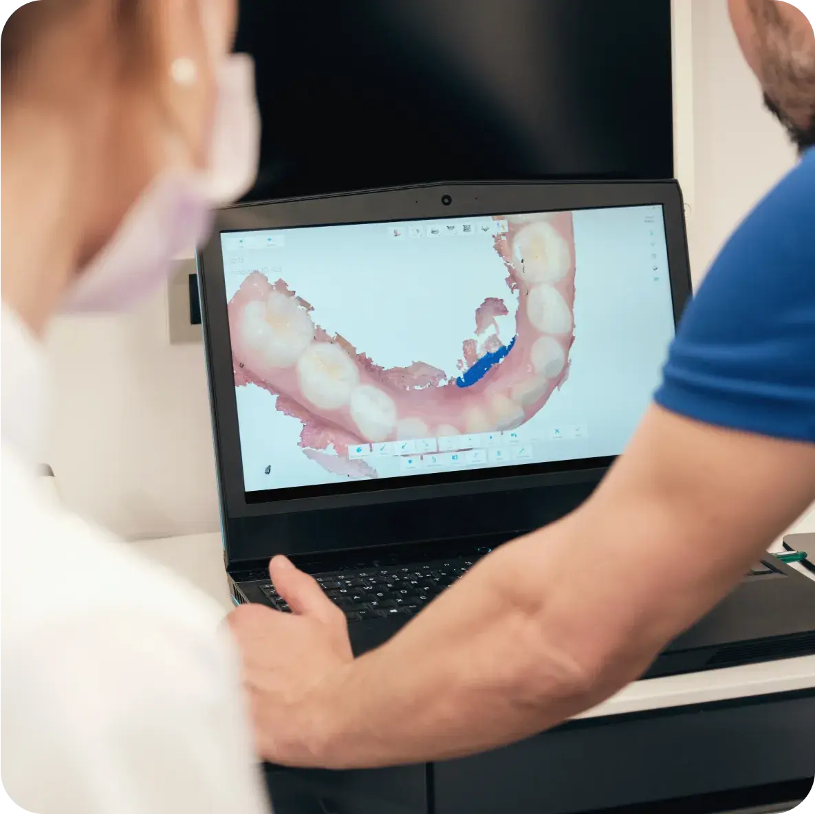 Intraoral 3D scan results shown on a laptop screen.