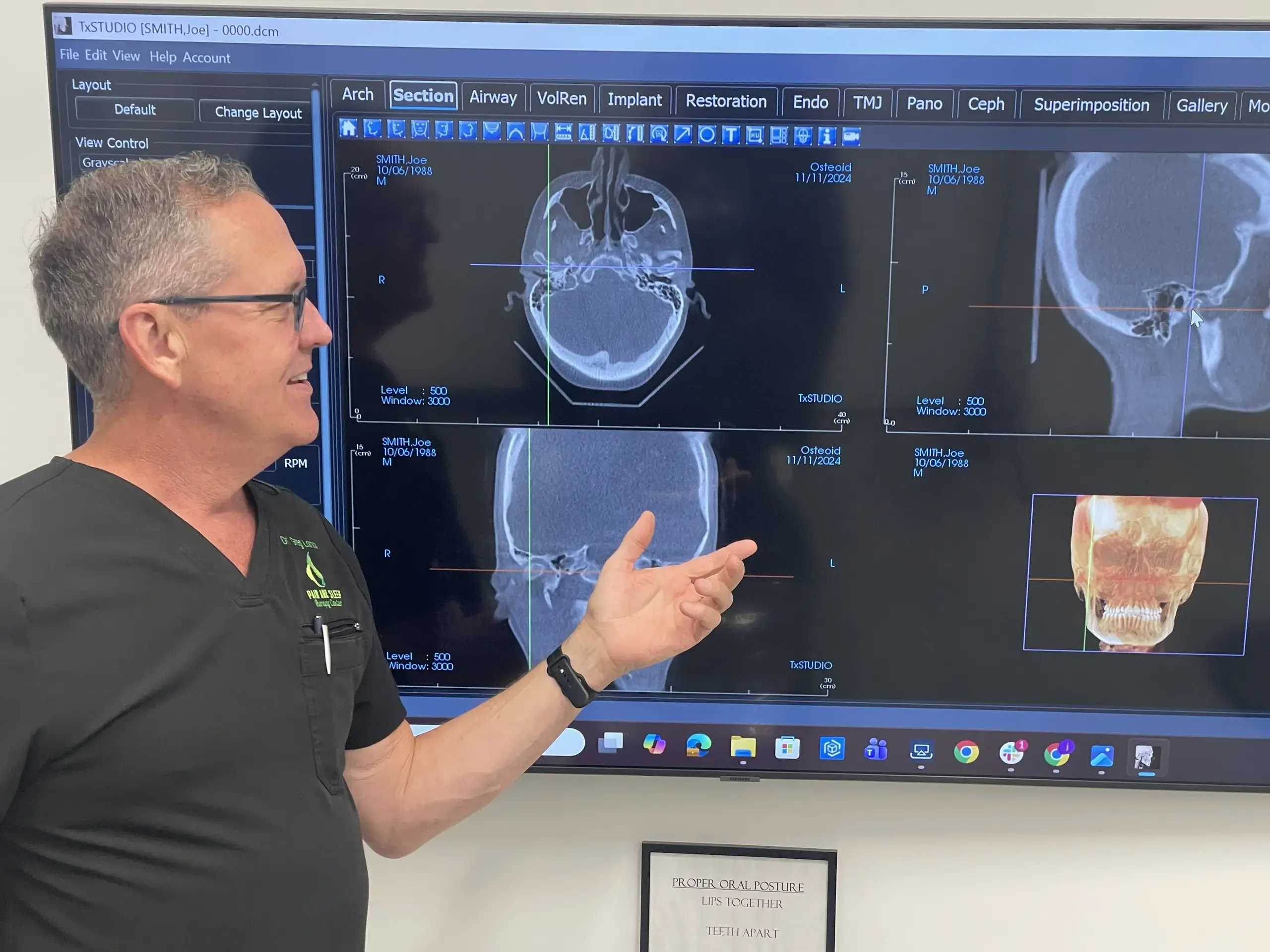 Dr. Greg Larson reviewing a 3D CBCT reconstruction in TxSTUDIO.