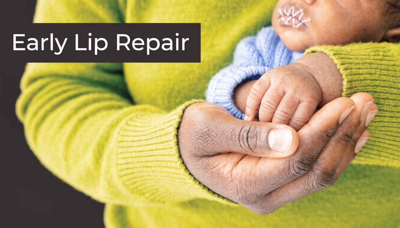 A gentle adult hand cradles the small hand of a newborn baby recovering from cleft lip surgery.