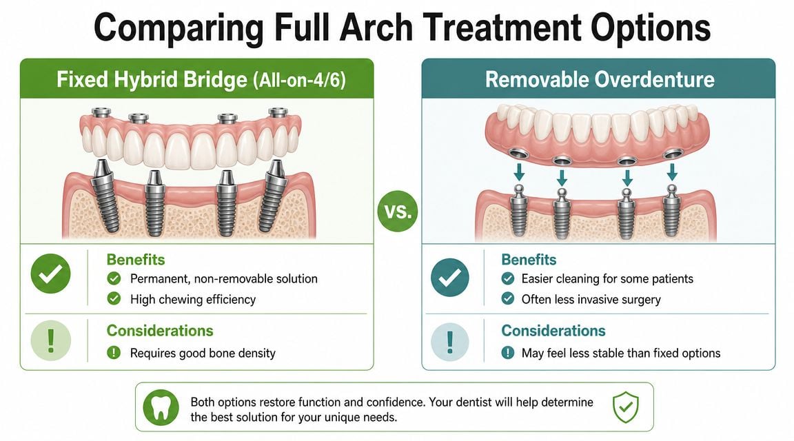 A comparison chart showing the differences between fixed hybrid bridge and removable overdenture full arch dental implants.