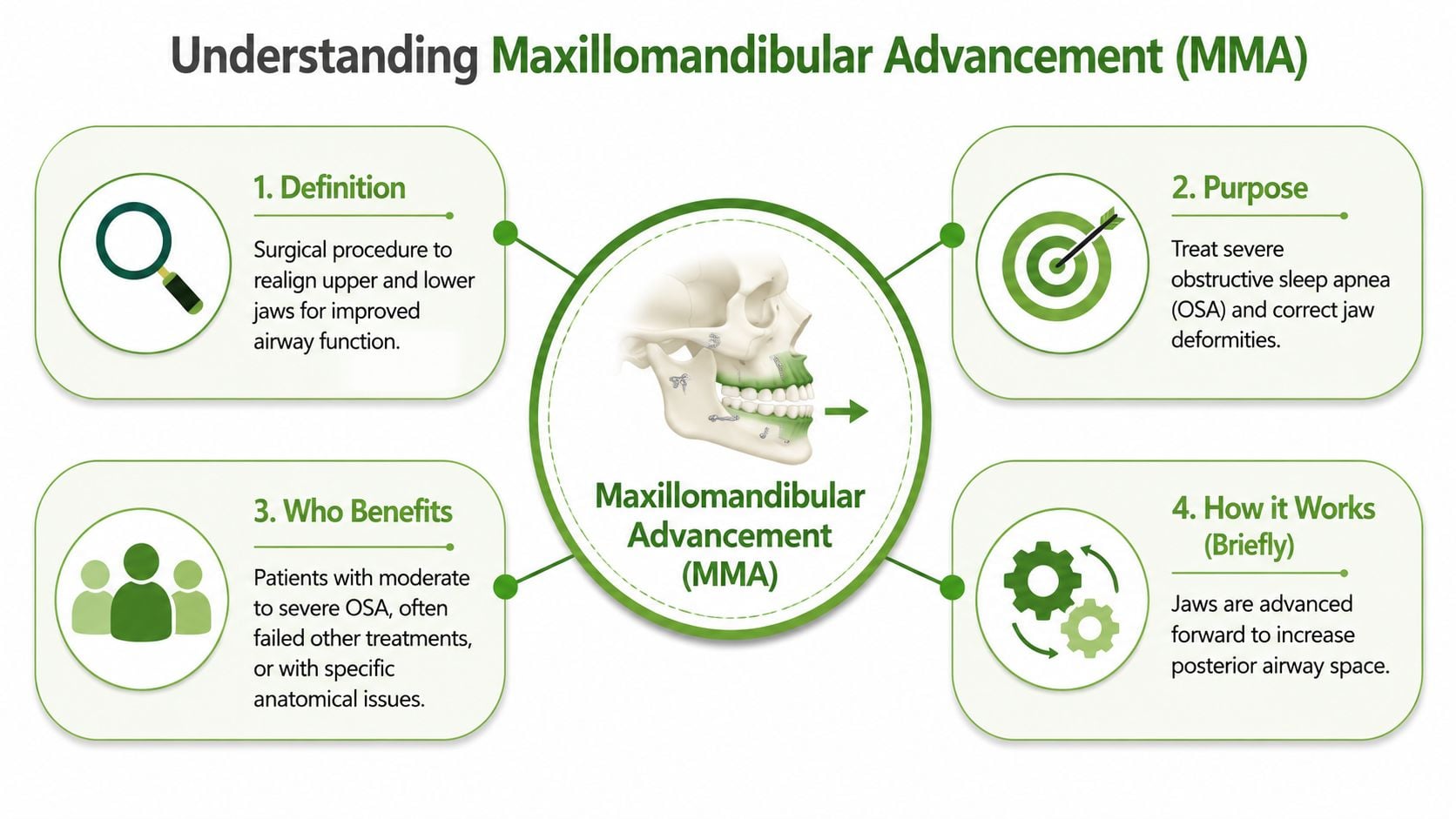 An infographic explaining the maxillomandibular advancement surgery procedure to treat severe obstructive sleep apnea and jaw deformities.