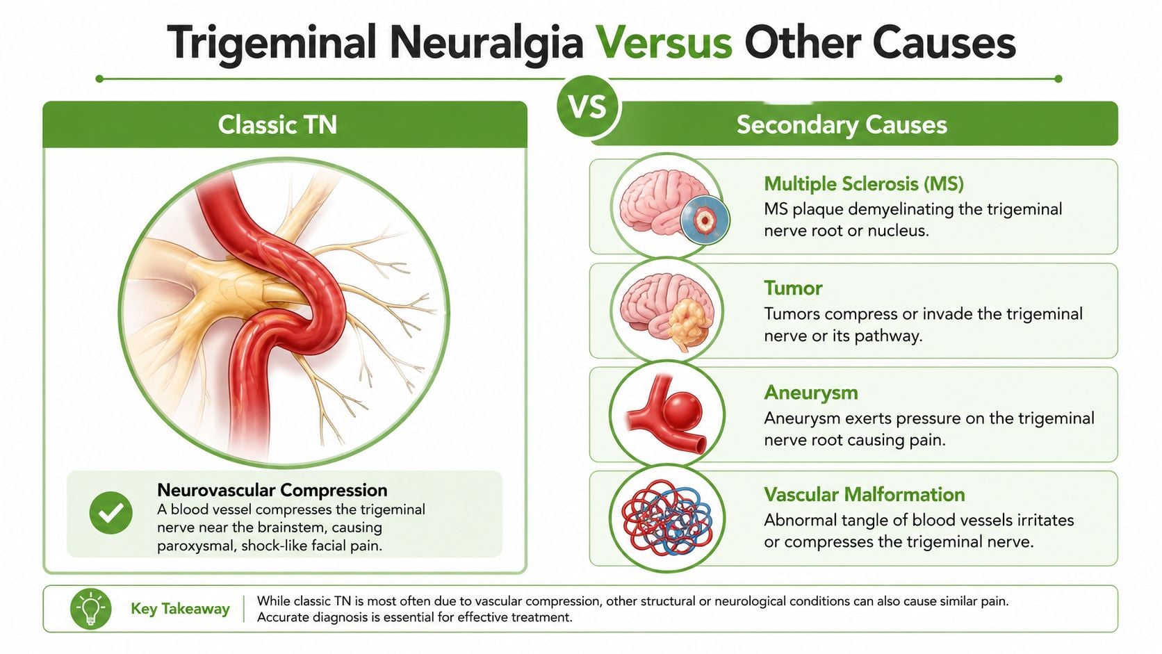 An infographic comparing classic trigeminal neuralgia caused by blood vessel compression to secondary causes like tumors or MS.