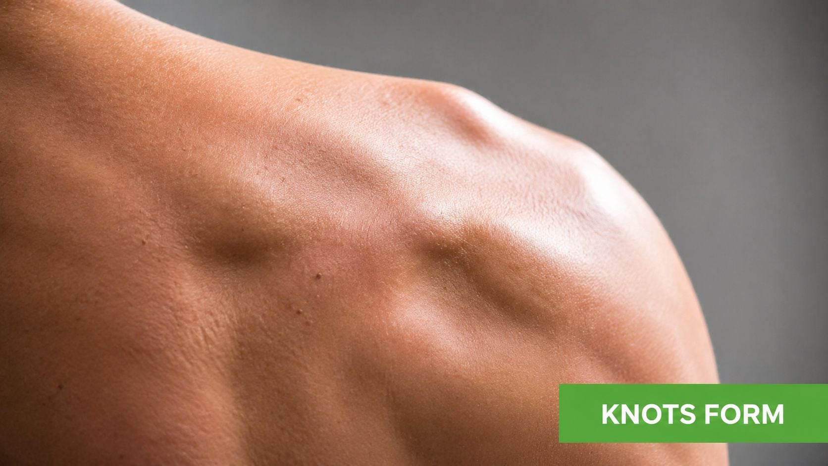 A close-up view of a person's shoulder blade area highlighting potential muscle tension and trigger points.